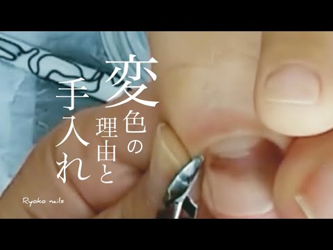 黒く変色した爪どうしたらいいの？ペディキュアVol.127　Pedicure