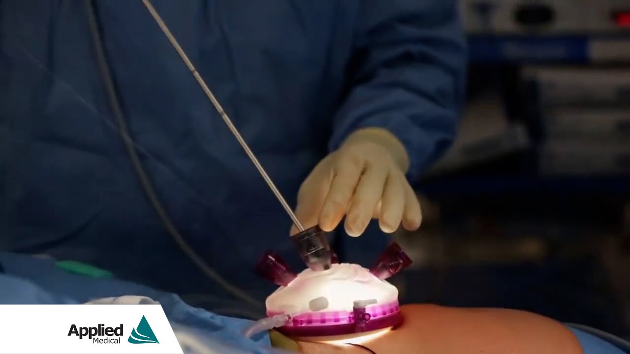 single-site-sigmoid-colectomy-featuring-the-gelpoint-advanced-access