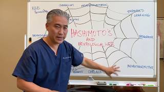 Hashimotos Thyroiditis And Neurological Web.