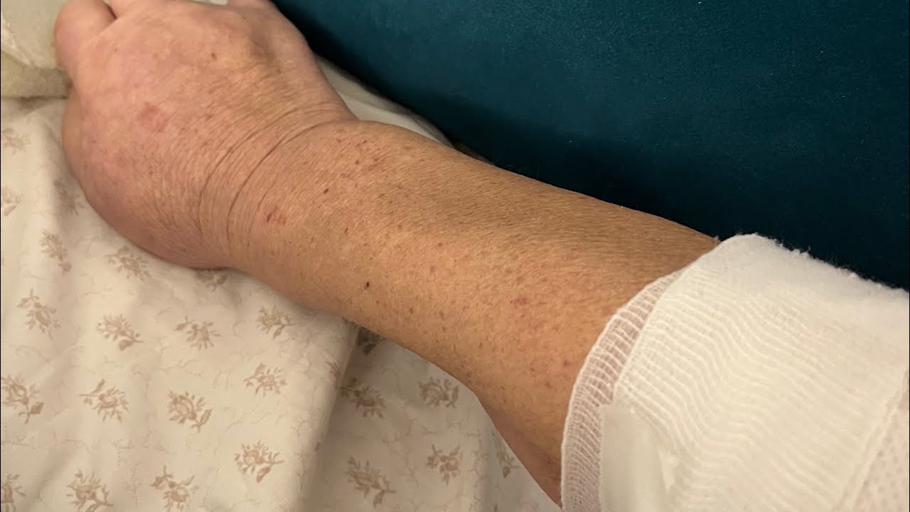 Mamina priča: karcinom pankreasa; hrabrost i borba, posljednje zbogom #cancer #fight 