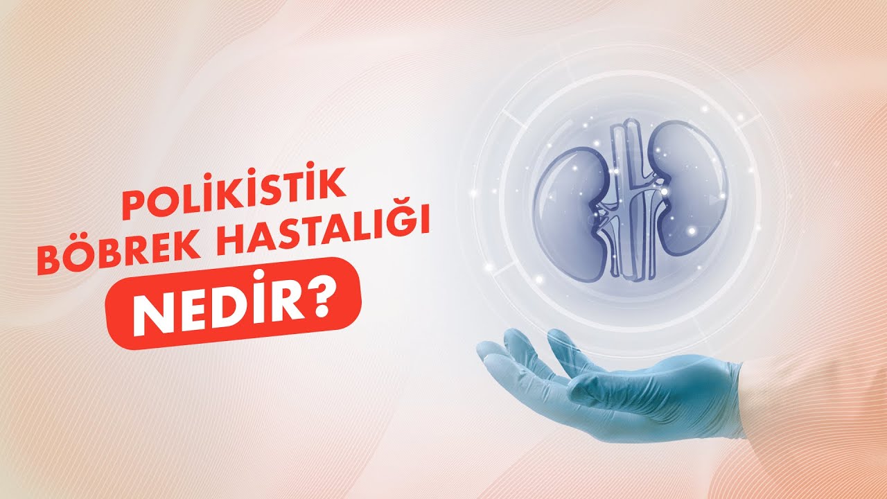 Polikistik Böbrek Hastalığı Nedir? Nasıl Tedavi Edilir?