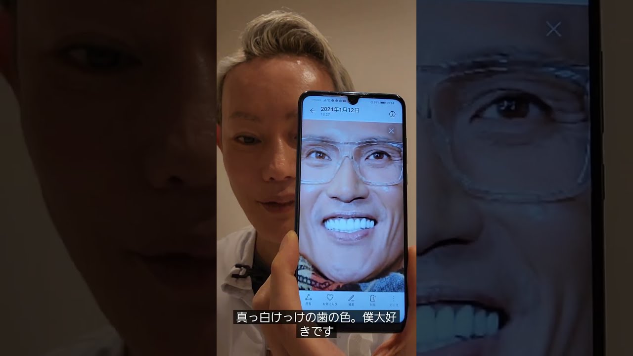新庄監督の最新の歯はインプラント⁉️#新庄監督#新庄剛志#セラミック#インプラント