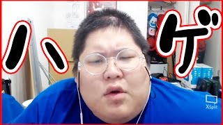 どうしてハゲてるの 恭ちゃんの生質問コーナー 1 Youtube どうしてハゲてるの 恭ちゃんの生質問コーナー 1 Youtube
