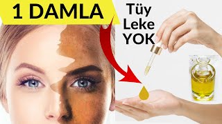 Limonla Öyle Bir Yağ Yaptım ki En İnatçı Kahverengi Lekeler, İstenmeyen Tüyler, Silindi Gitti