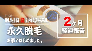 【脱毛2ヶ月目】FASÏZ(FASIZ)IPL脱毛器でお家で永久脱毛の経過報告！【MicchiVlog/272】