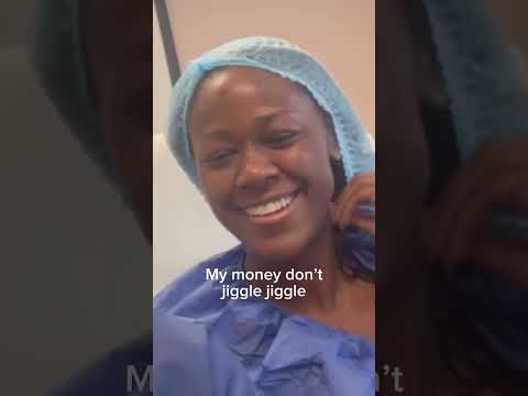 Alarplasty Before and After - Dr. Janjua