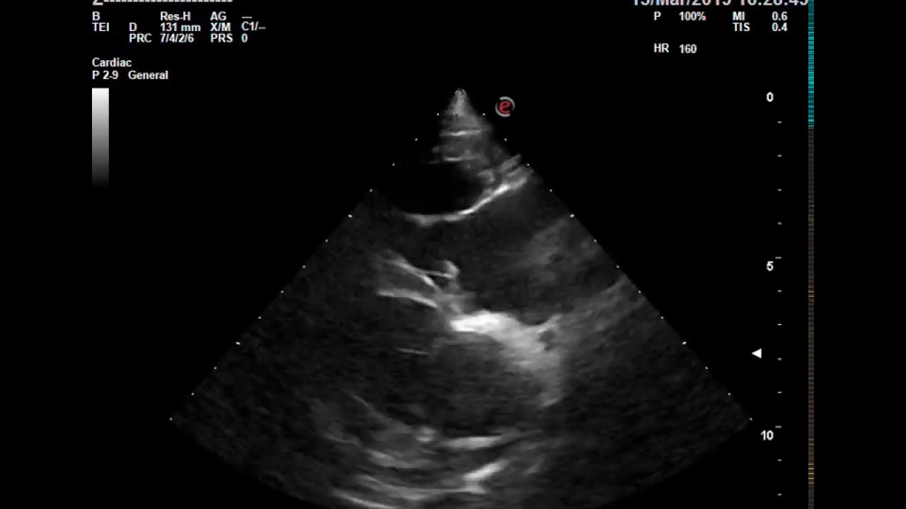 esaVET badanie echo psa Guz podstawy serca MyLabOmega YouTube
