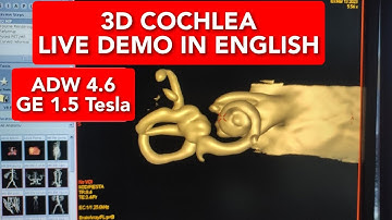 3D Cochlea on ADW 4.6 | Live Demo in English