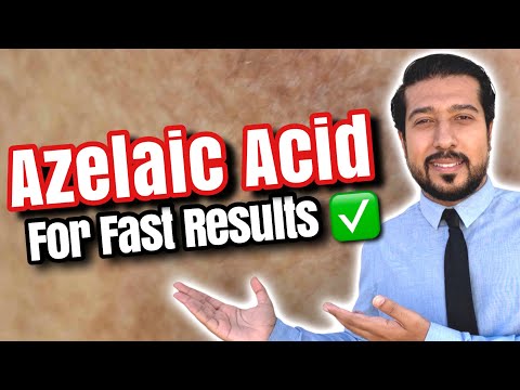 Azelaic Acid for Melasma | How to Use Azelaic Acid for SUCCESS 