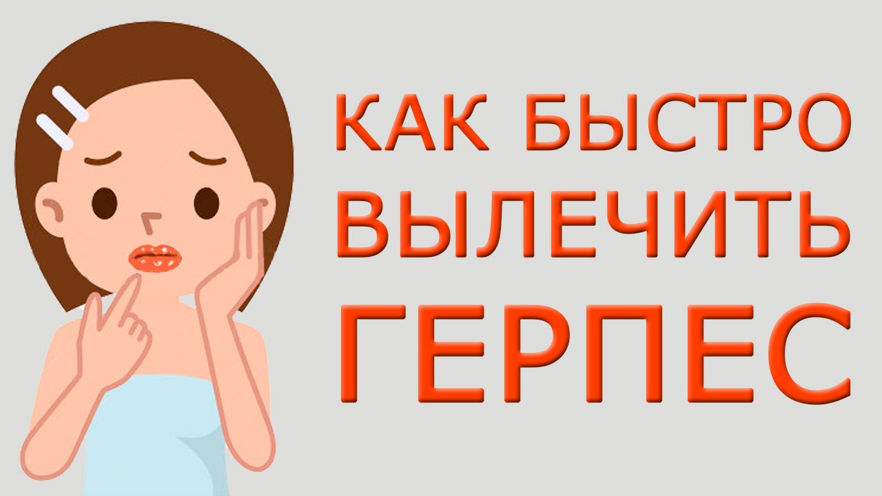 Простуда на губах - быстрое лечение в домашних Простуда на губах - быстрое лечение в домашних