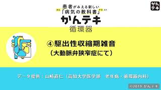 ④ 駆出性収縮期雑音（大動脈弁狭窄症にて）