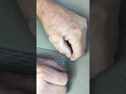 cigarette-burn-repair-the-easy-way