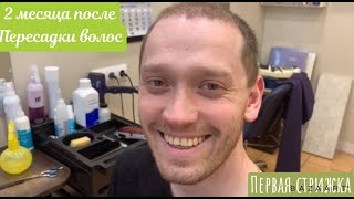 2 Месяца после пересадки ВОЛОС| Hair Transplant 2 Months| #пересадкаволос #пересадкаволосрезультаты