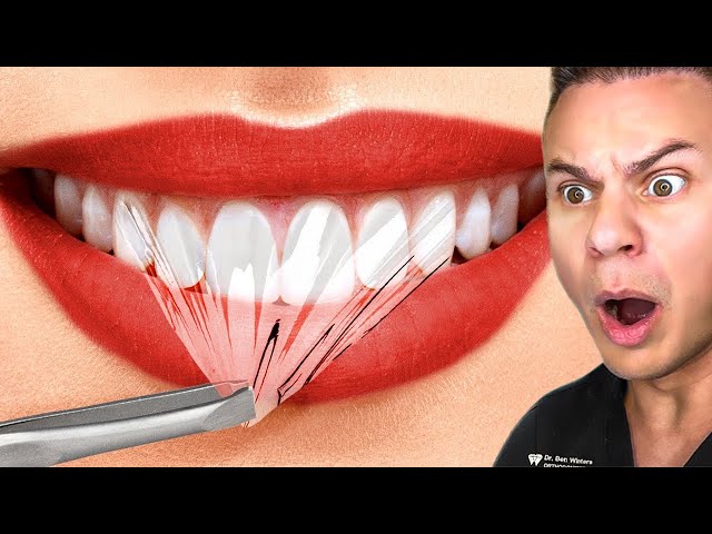 Orthodontist Busts DUMBEST Dental Myths class=