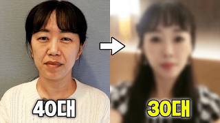 ✔40대 동안성형 브이로그 | 출혈로 수술 중단..?💥 | 상안검, 리프팅, 지방이식 브이로그 [하민2Vlog]