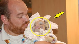 This baby scared the whole internet! This is what happened to him after 5 years!