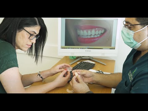 וִידֵאוֹ: כיצד ליישר שיניים בפוטושופ