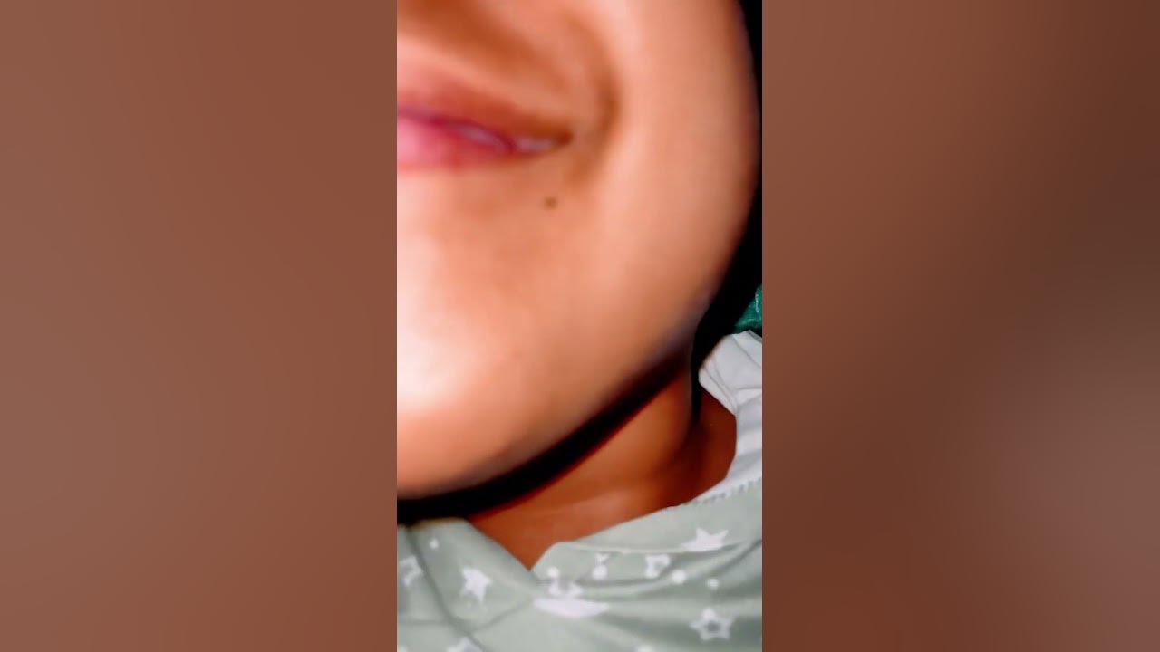 why-does-my-lip-keep-bleeding-youtube