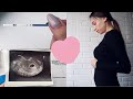 Я БЕРЕМЕННА🤰🌸 ПЛАНИРОВАНИЕ БЕРЕМЕННОСТИ/ МОЯ РЕАКЦИЯ💕