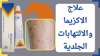 علاج الاكزيما والالتهابات الجلدية  ميكسدرم MIXDERM