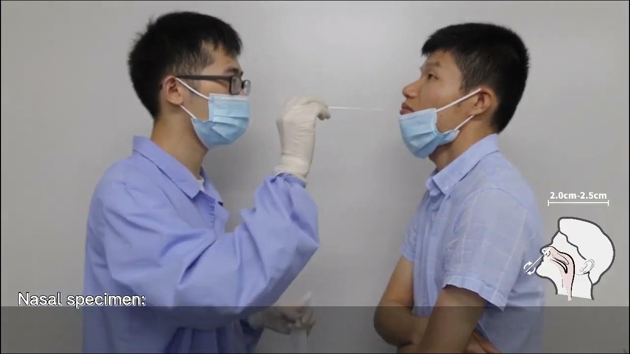 SARSCoV2 Antigen Covid19 Rapid Test (Nasopharyngeal/Nasal swab