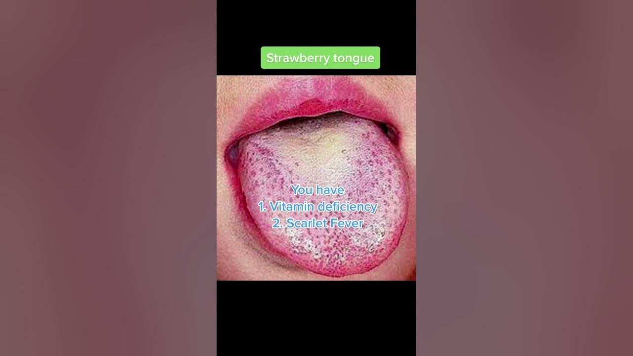 the-inside-of-your-mouth-is-full-of-stories-that-reveals-your-habits