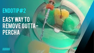 Endotip #2 : easy way to remove gutta- percha in Endodontic retreatments.