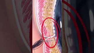 Screens Can Dry Out Your Eyes