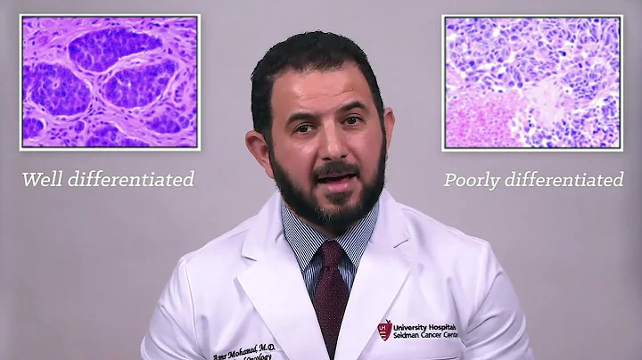 Diagnosing Neuroendocrine Tumors