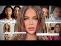 FACE FILTERS ARE DESTROYING YOUR FACE…
