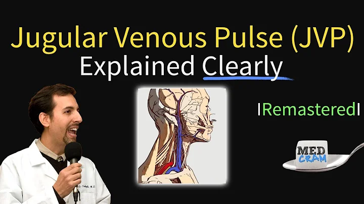 Jugular Venous Pulse (JVP) - Waveforms & Evaluation for JVD