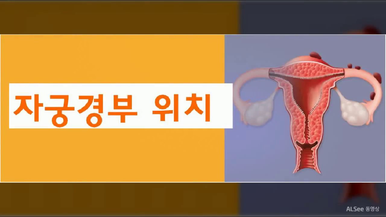 자궁 경부 위치 - YouTube