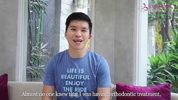 Niềng răng trong suốt Invisalign | Niềng răng không mắc cài tại nha khoa Elite