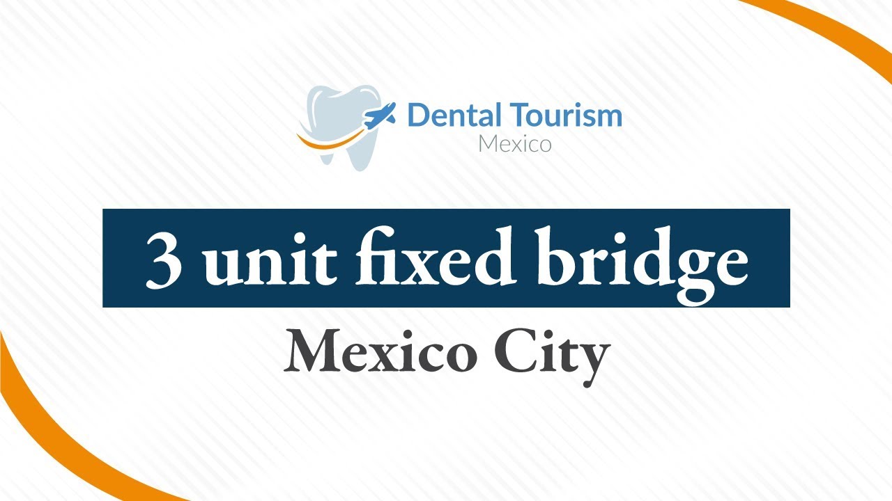 3 Unit Bridge - Mexico City