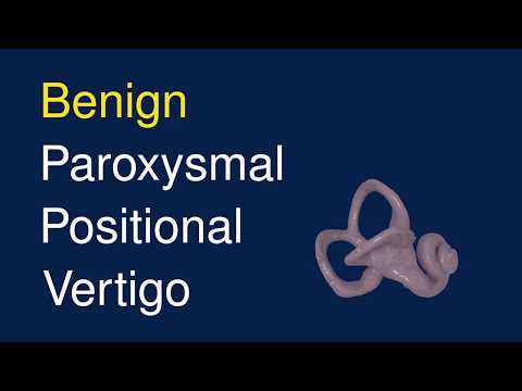 Benign Paroxysmal Positional Veritgo (BPPV)