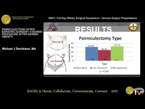 Video: Panniculectomy: Procedūra, Atsigavimas Ir Komplikacijos