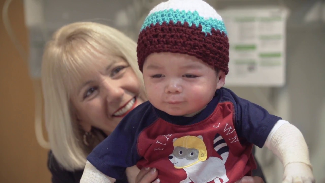 Alec | Shriners Hospitals for Children