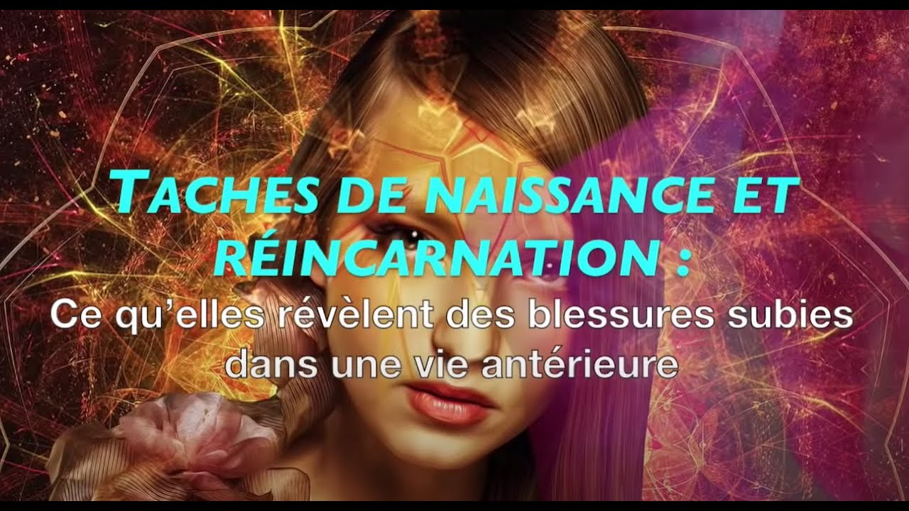 Taches de naissance ce qu’elles révèlent des blessures subies dans une vie antérieure YouTube Taches de naissance ce qu’elles révèlent des blessures subies dans une vie antérieure YouTube