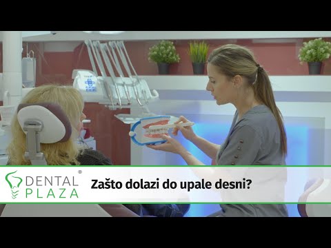 Video: Zašto Su Djetetu Tamne Desni?