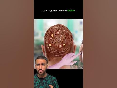 Скала Дуэйн Джонсон заболел - YouTube