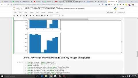ECG-Arrhythmia-Classification