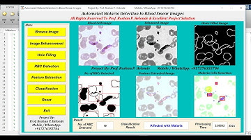 Malaria Detection Using Image Processing | IEEE Based Projects | With Source Code