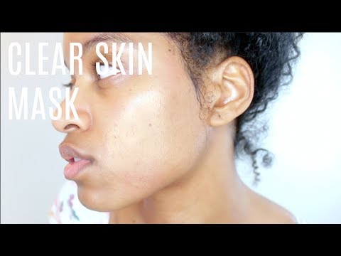 Get Glowing Acne Clear Skin With Aloe Vera Gel Mask (Helps Peeling Skin, Lighten Dark Spots)