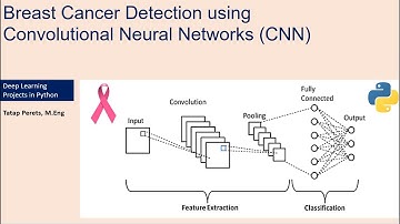 Breast Cancer Detection using Convolutional Neural Networks (CNN)