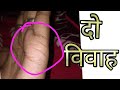 Double marriage line in hand || दो विवाह के योग