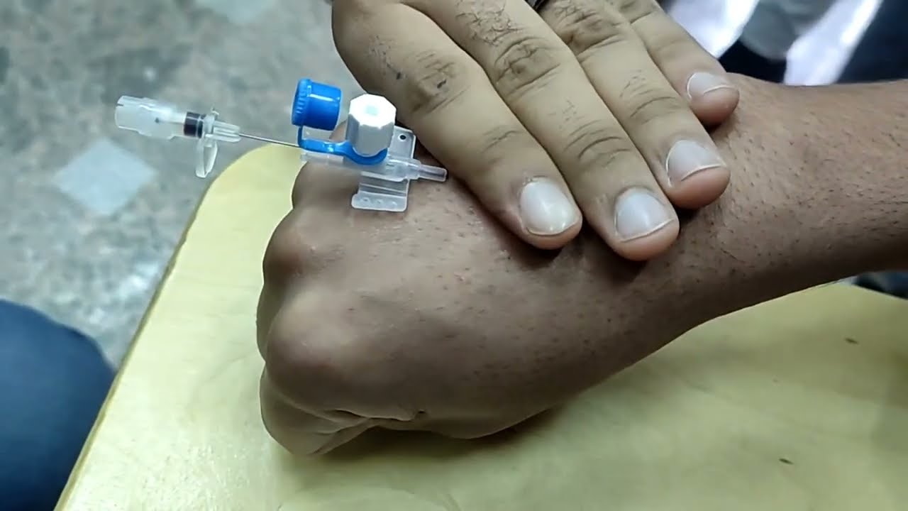 تركيب الكانيولا شاهد فيديو عملي بالشرح لكيفية تركيب كانيولا الوريد وإعطاء المحاليل cannula insertion