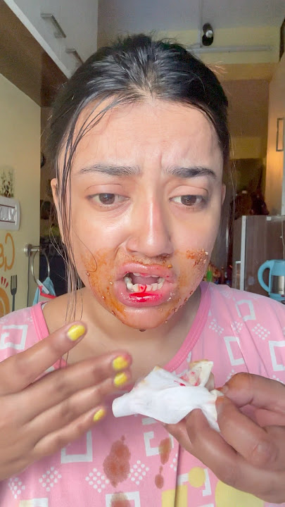 Shoking* 😱👄 Lips se Blood 🤯🩸 #lips #makeuphacks #short #shorts #trendinghacks #shortvideo #hack #lip