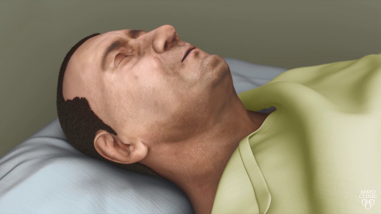 Что происходит во время обструктивного апноэ сна?