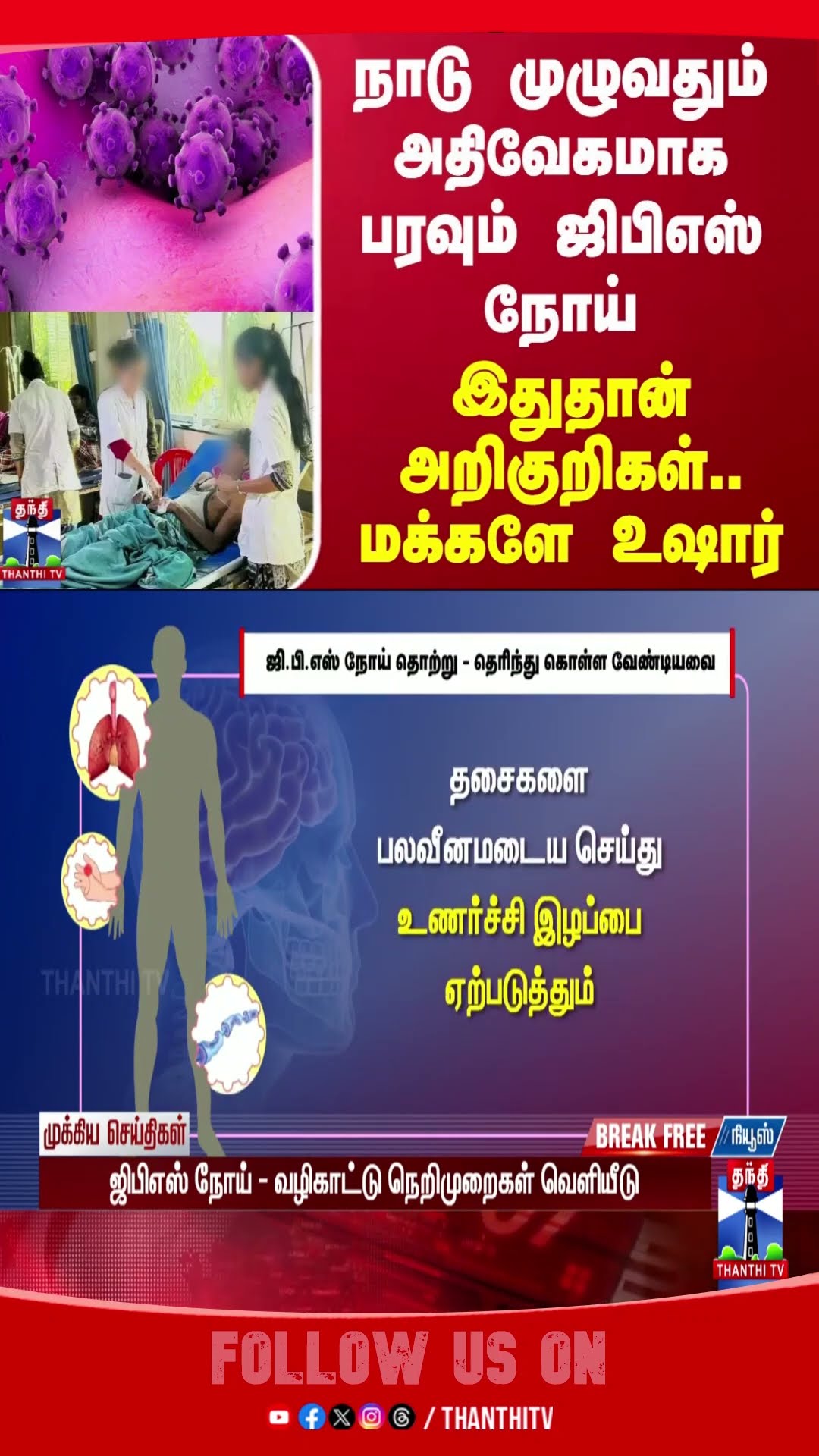 virus || GBS || hospital || people || awareness