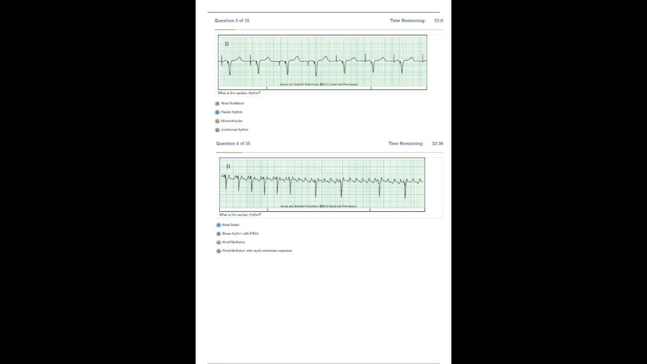 Relias Dysrhythmia Basic Test Answers 2023 Dysrhythmia – Basic A A+